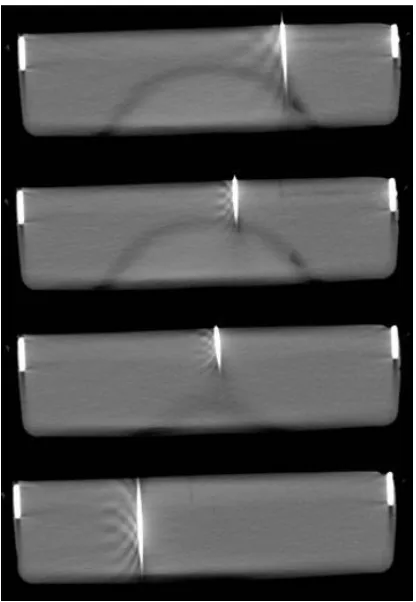 Fig. 5.DICOM images from CT scans. the needle is inserted on the markedDICOMentry points and a CT scan taken.plane