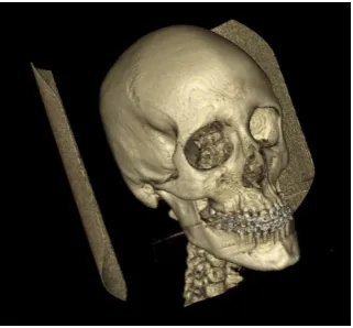 Fig. 1. DICOM images representation.