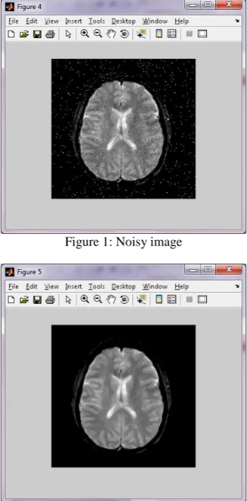 Figure 1: Noisy image  
