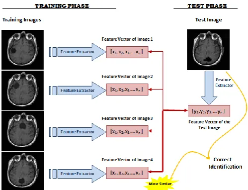 Figure 3: Schematic diagram of a MR image recognizer 