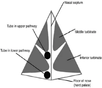 Figure 9: Showing pathways of tube passage during Nasotracheal 