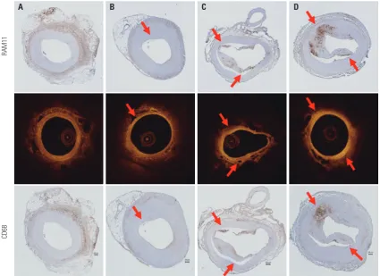 Fig. 7. OCT matching with histomorphometry for macrophage infiltration. OCT images obtained in vivo were matched with histomorphological section of rabbit models for macrophage infiltration