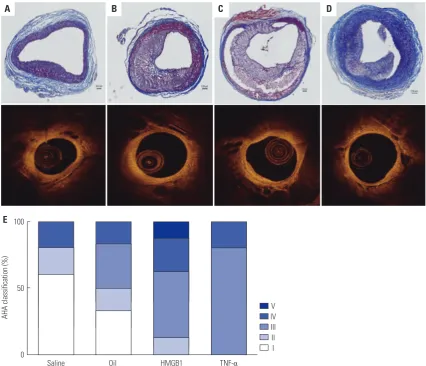 Fig. 6. OCT images of matched rabbit iliac artery histologic sections and histologic classification based on AHA criteria
