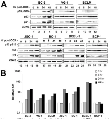 FIG. 3. Doxorubicin treatment of PEL lines activates the p53-mediated DNA damage response