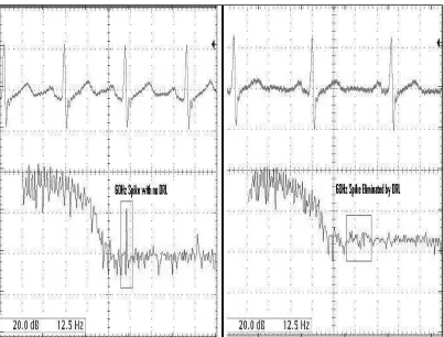 Figure 16: Attaching a DRL circuit eliminates the 60Hz spike in the biosignal trace.
