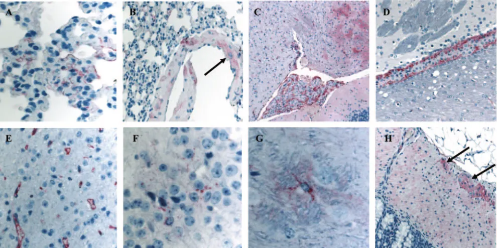 FIG. 6. Expression of hACE2 in the lungs, brain, and GI tract of Tg�were used to evaluate the expression of the hACE2 by IHC