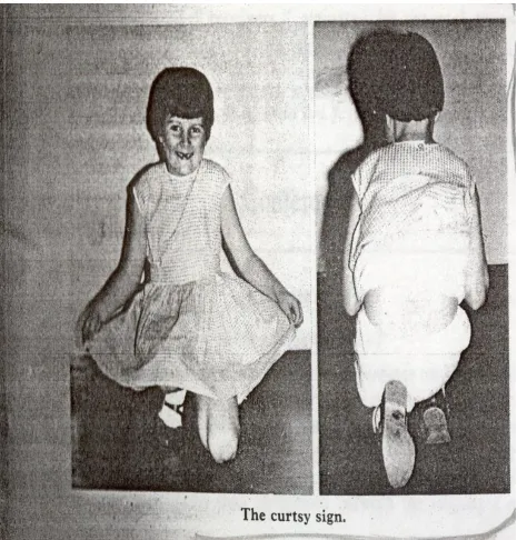 Fig 5(i)  The Curtsy Sign