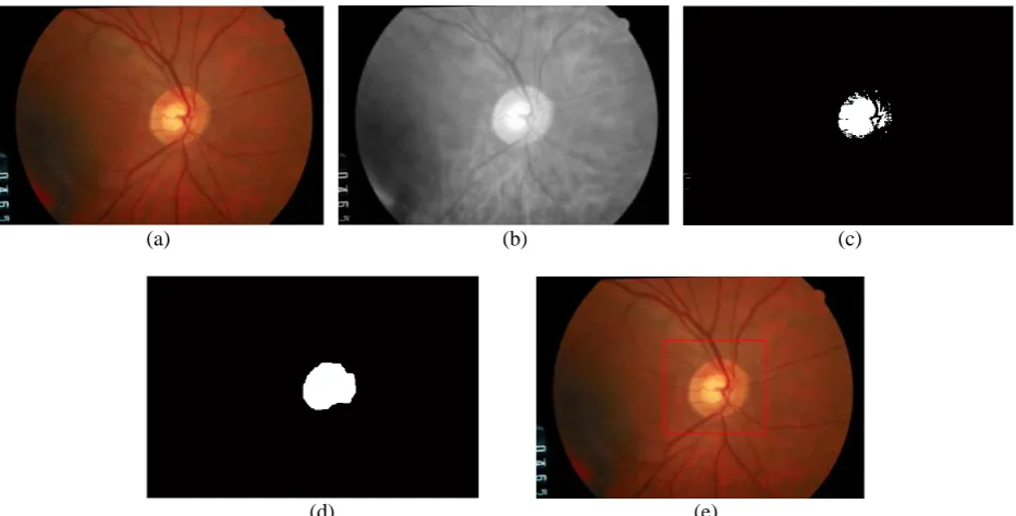 Figure 4 Localization of Optic Disc. (a)Original Image. (b)Red channel Image (c)Thresholded Image