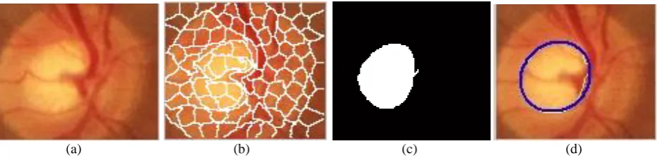 Figure 6 Superpixel Segmentation of Optic Cup and Boundary Detection (a)Optic Disc Bounding Box