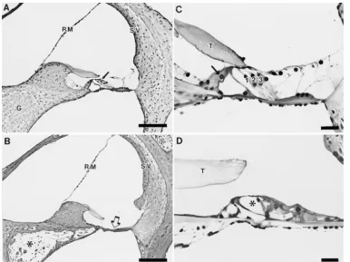 Figure 1.—Histological anal-ysis of the cochlea from normal