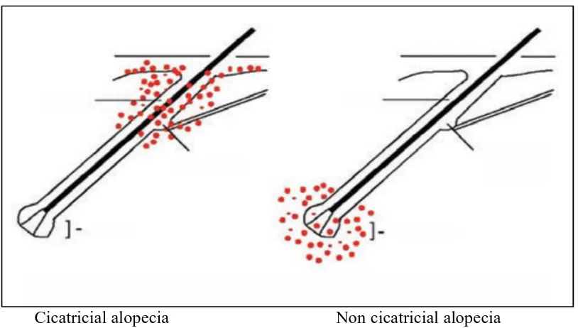 Figure 629: difference between cicatricial and non cicatricial alopecia 