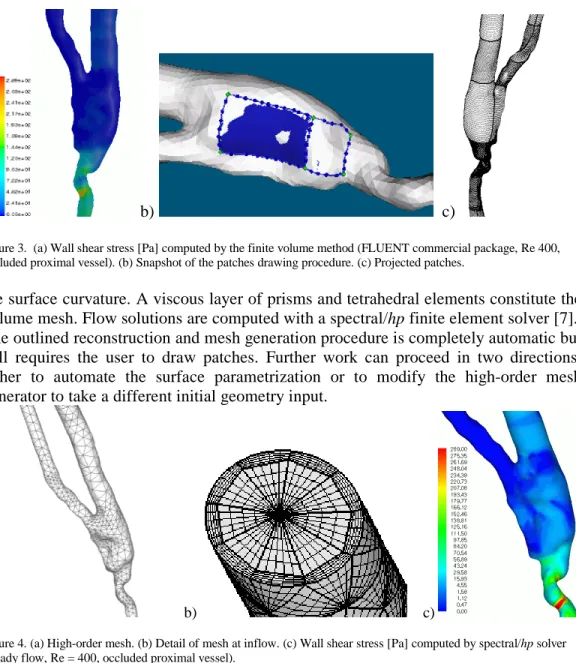 Figure 3.  (a) Wall shear stress [Pa] computed by the finite volume method (FLUENT commercial package, Re 400,  occluded proximal vessel)