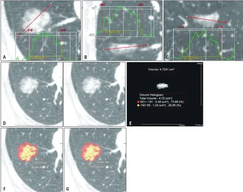Fig. 1. Representative examples of 3D segmentation and measurement of parameters. 3D segmentation performed using the lung window setting (window width=1465 HU; level=-498 HU)
