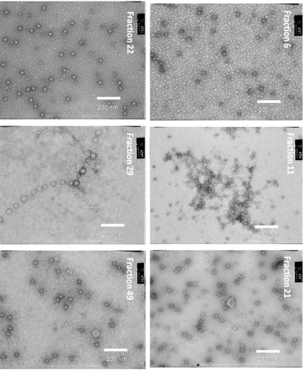 Figure 4. TEM analysis of FPLC fractions of RCNMV separated on a Q sepharose FF 