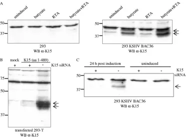 FIG. 1. A K15 protein of 45 kDa is expressed in 293 cells stably transfected with KSHV BAC36