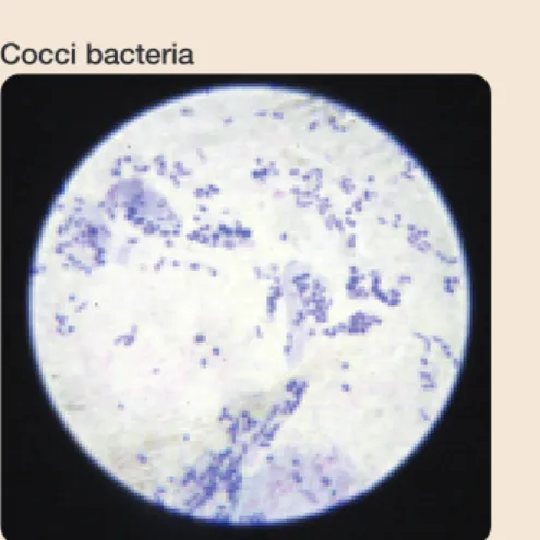 Figure 3: Harmful Organisms of the Ear Canal 