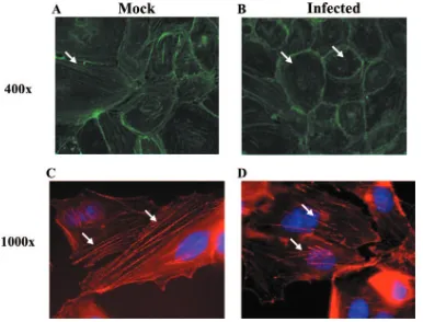 FIG. 9. HCMV infection of endothelial cells disrupts actin stress ﬁber formation. HMECs were grown on ﬁbronectin-coated coverslips andmock infected or HCMV infected (MOI, 20) for 24 h