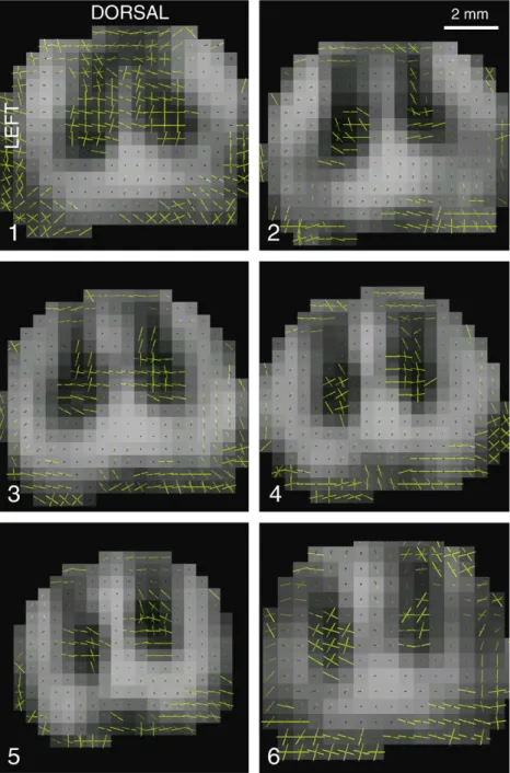 Fig. 3. Comparison of extracted maxima along the cord. Each axial slice is 3 mm thick, covering a rostro-caudal region 18 mm long, centred at L5