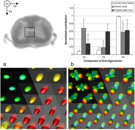Fig. 5. Comparison between DTI and QBI. a: Axial anatomical MRI with a selected region including the white matter, the central canal and partially the dorsal and ventral horn
