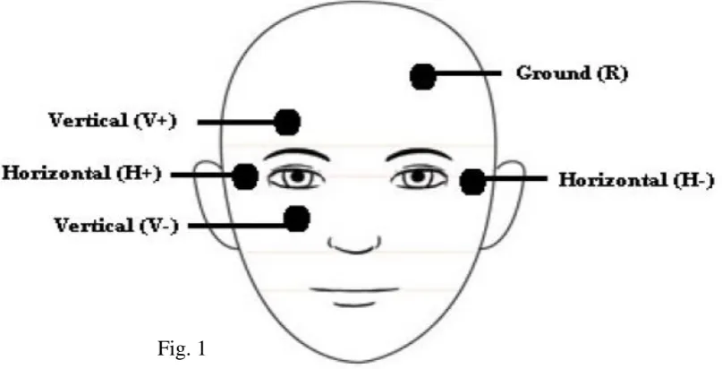 Fig. 1  
