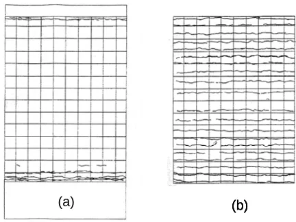 Fig. 8 Concrete Cracks (a) Outer and (b) Inner Sidewalls 