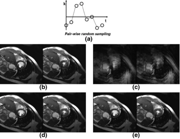 FIG. 8. In vivo experimental results. In order to reduce eddy current effects, pair-wise random sampling pattern as shown in (a) was employed at the acceleration factor of six