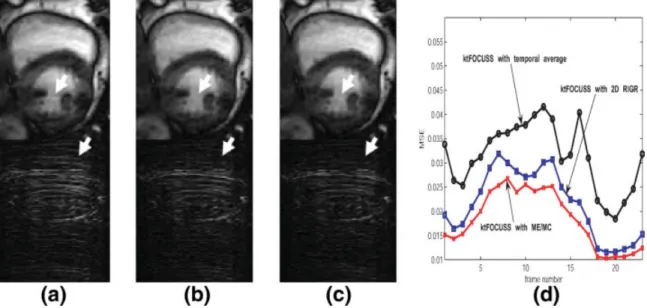 FIG. 9. When two fully sampled reference frames are not available, 2-D RIGR and ME/MC can still work using temporal average as a reference frame
