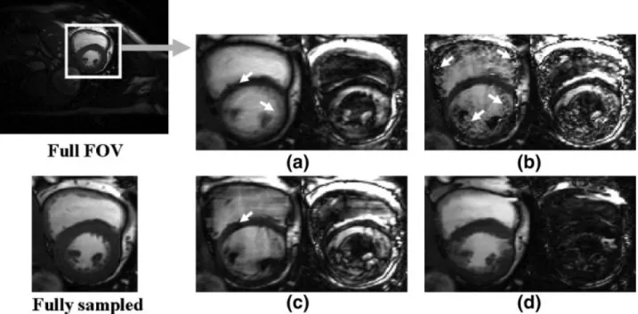 FIG. 4. Comparison of various prediction schemes. Temporal average, conventional RIGR, 2-D RIGR, and ME/MC are shown in (a), (b), (c), and (d), respectively