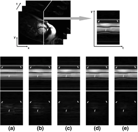 FIG. 6. Reconstructed y-t slices are shown to compare the temporal variation. On the top, the reference image from fully sampled k-t data is shown