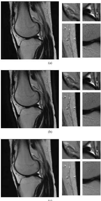 Fig. 5: 4 coil images g i ’s with different coil sensitivities.