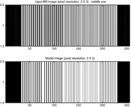 Fig. 9. Image reconstructed from MR scanner data at FOV = 230.4 mm (top) vs. the mathematical model (bottom)