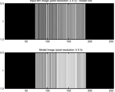 Fig. 11. Image reconstructed from MR scanner data at FOV = 384 mm (top) vs. the mathematical model (bottom)