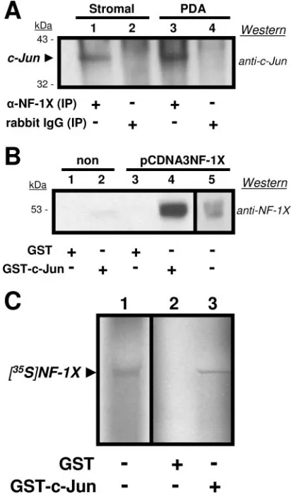 FIG. 3. (A) Anti-NF-1 Western blots demonstrate differential ex-pression levels of three of the four NF-1 class types in comparisons