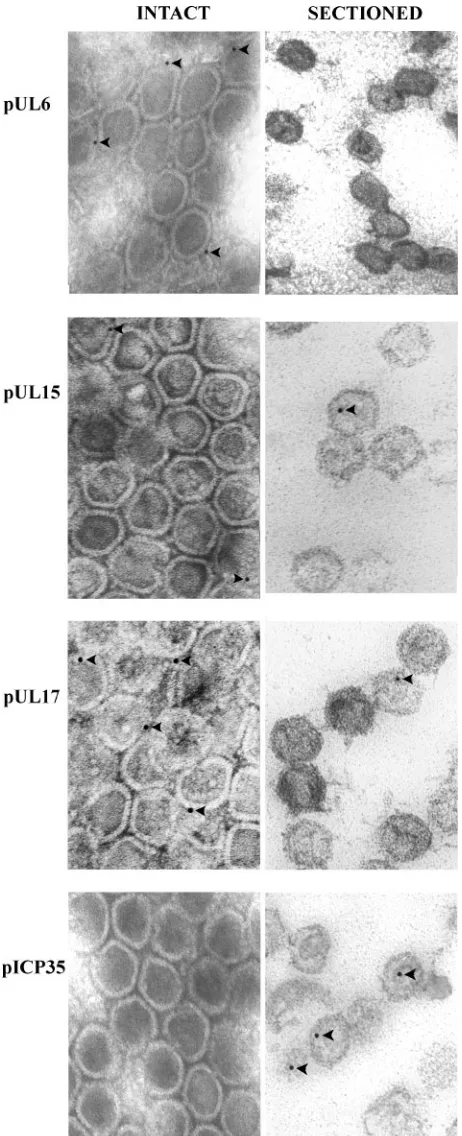 FIG. 2. Digital image of representative electron micrographs ofcapsids labeled with various antibodies
