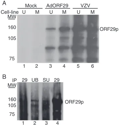 FIG. 1. Analysis of ORF29p electrophoretic mobility. (A) MeWo(M) (lanes 2, 4, and 6) and U373MG (U) (lanes 1, 3, and 5) cells were