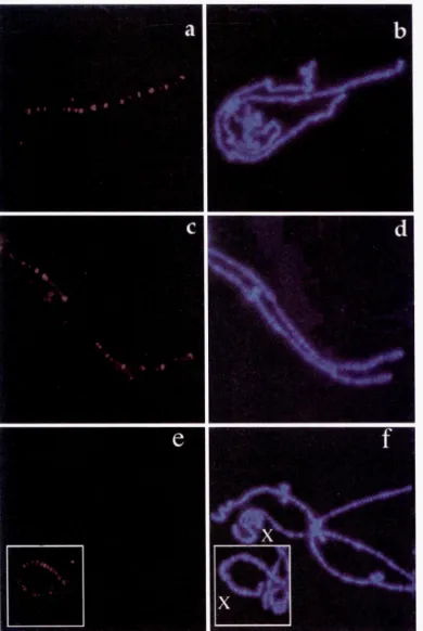 FIGURE 1.-Indirect im- munofluorescence to  de- 