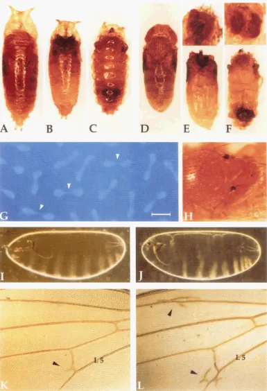 FIGURE 2.-Morphological  defects of indented concentric rings,  giving it a "Michelin-man" appearance