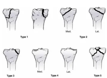 Figure 2 Moore classification