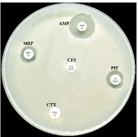 Fig:13 : AST by  Kirby – Bauer Method (Mueller Hinton Agar)  