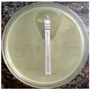 Fig 19: E-TEST FOR MBL PRODUCTION RESISTANT TO MEROPENEM. 