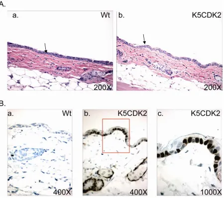 Figure 4.  K5CDK2 skin morphology and immuno-localization of transgene expression.  (A)  H & E stained cross-sections of paraffin embedded wild type and K5CDK2 skin shows similar overall skin morphology