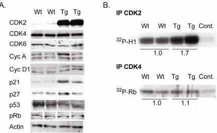 Figure 6.  Cell cycle regulatory protein expression and CDK kinase activity in K5CDK2 epidermis
