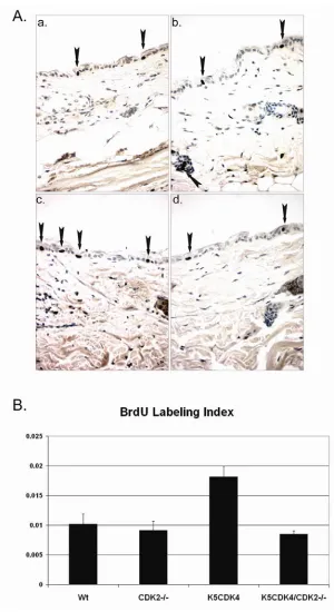 Figure 10.  Epidermal proliferation in K5CDK4/CDK2-/-K5CDK4 (c), and K5CDK4/CDK2 compound mice