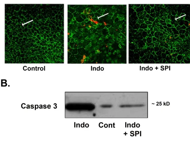 Figure 5. Expression of activated caspase-3  