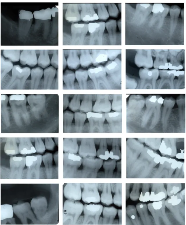 FIG 1 - Radiographs found in our AM database. 