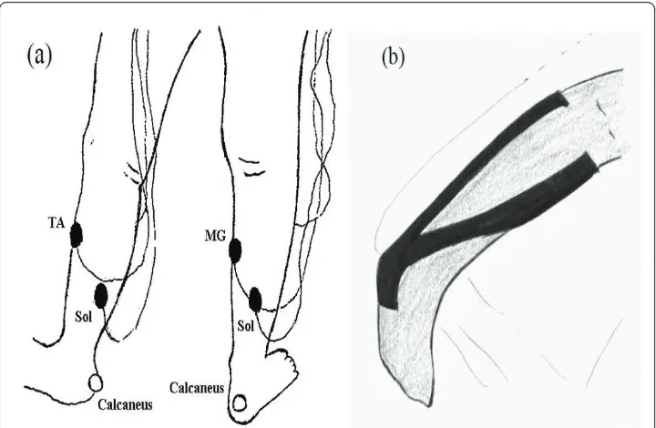 Figure 1 The attached positions of EMG electrode and reflectorwas recorded from the medial gastrocnemius (MG), tibialis anterior (TA), and soleus (Sol) muscles usingAg-AgCl electrodes