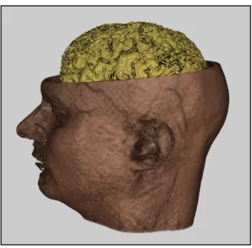 Figure 2: Registering sensor locations with MRI-based data reveals the spatial relationships between the EEG sensors and the structures evident in the MRI volume.