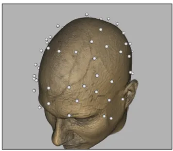 Figure 3: Registering sensor locations with MRI-based data reveals the spatial relationships between the EEG sensors and the structures present in the MRI volume.
