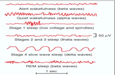 Figure 2 EEG pattern during sleep 