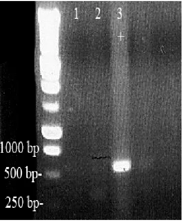 Figure 3. PCR analysis of DNA From embryo #12. Samples containing the bryos. represents DNA from  liver tissue